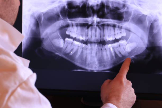 Best Orthodontic Emergency Dentist in St John, IN